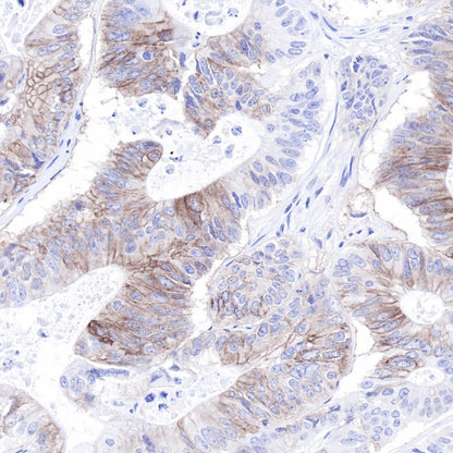 S-RMab® CD117 Recombinant Rabbit mAb,PBS Only (SDT-125-51)