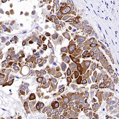 Cytokeratin 6A (KRT6A) Recombinant Mouse mAb (SDT-3380)