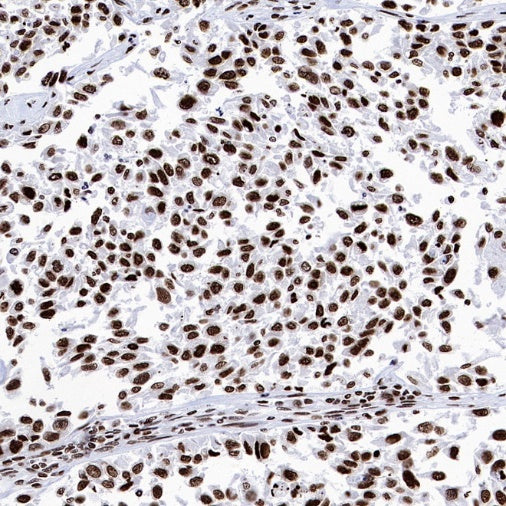 Histone H4 (Lactyl K5) Recombinant Rabbit mAb (S-3220-73)