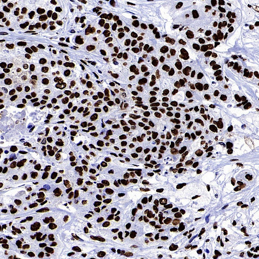 hnRNP U Recombinant Rabbit mAb (S-2375-23)