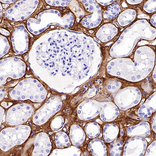 COL1A1 Recombinant Rabbit mAb (S-2975-9)