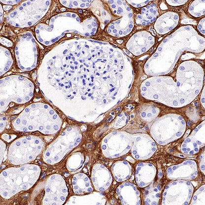 COL1A1 Recombinant Rabbit mAb (S-2975-9)