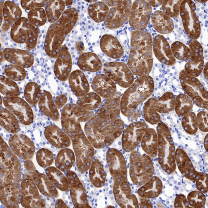 CBS Rabbit Polyclonal Antibody