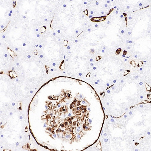 PTRF Recombinant Rabbit mAb (S-3271-13)