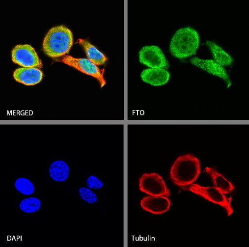 FTO Recombinant Rabbit mAb (S-1663-48)