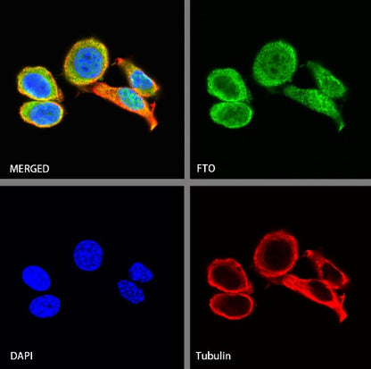 FTO Recombinant Rabbit mAb (S-1663-48)
