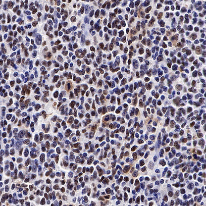 PARP1 Recombinant Rabbit mAb (S-220-179)