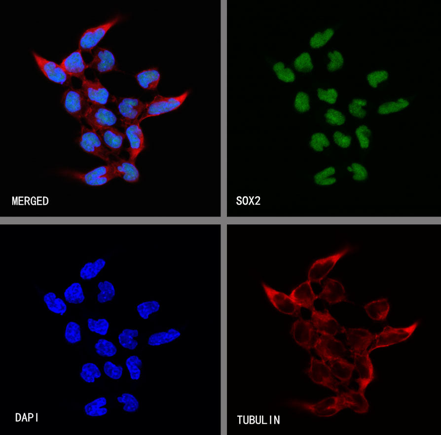 SOX2 Recombinant Rabbit mAb (S-5000)