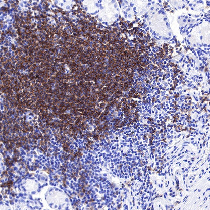 CD19 Recombinant Rabbit mAb (SDT-164-33)