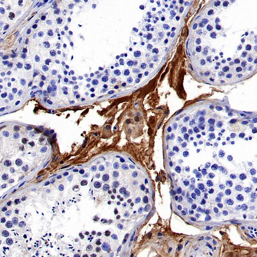 TRF Recombinant Rabbit mAb (S-613-85)