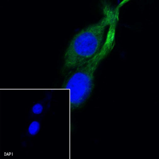 β-tubulin Recombinant Rabbit mAb (Alexa Fluor® 488 Conjugate) (S-312-113)