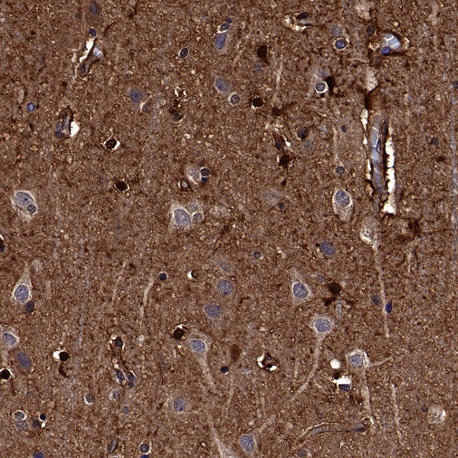 Peroxiredoxin 6 Rabbit Polyclonal Antibody