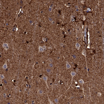 Peroxiredoxin 6 Rabbit Polyclonal Antibody