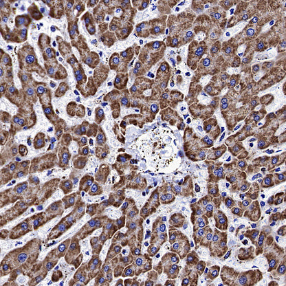 VDAC1 Recombinant Rabbit mAb (S-5314)