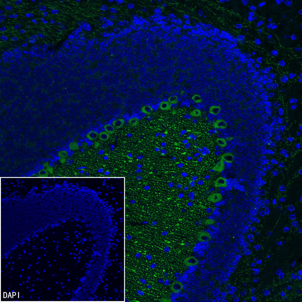 ITPR1 Recombinant Rabbit mAb (S-4530-47)