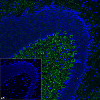 ITPR1 Recombinant Rabbit mAb (S-4530-47)