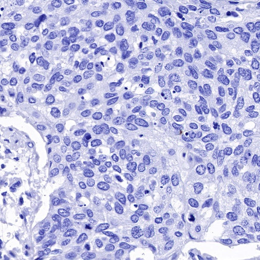 S-RMab® Helicobacter pylori Recombinant Rabbit mAb (SDT-R273)