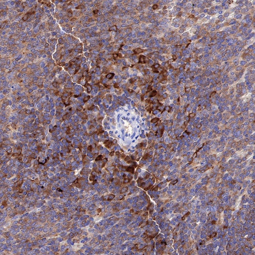 SQSTM1/p62 Recombinant Rabbit mAb (S-R346)