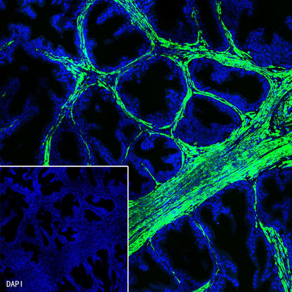 alpha smooth muscle Actin Recombinant Rabbit mAb (FITC Conjugate) (SDT-132-63)