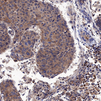 Atg5 Recombinant Rabbit mAb (SDT-456-9)