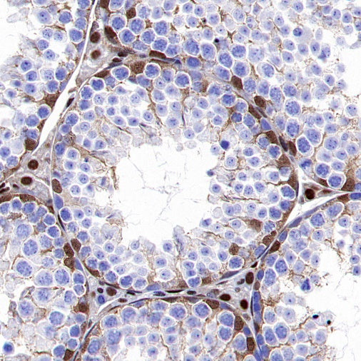 p27 Kip1 Recombinant Rabbit mAb (SDT-361-310)
