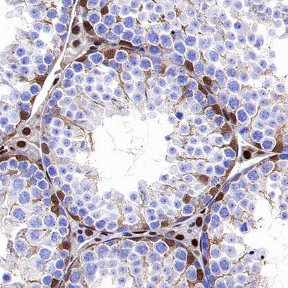 p27 Kip1 Recombinant Rabbit mAb (SDT-361-310)