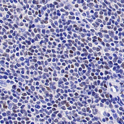 SOX11 Recombinant Mouse mAb (SDT-919-58)