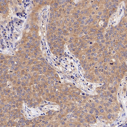 PI3 Kinase p85 beta Recombinant Rabbit mAb (S-1058-266)