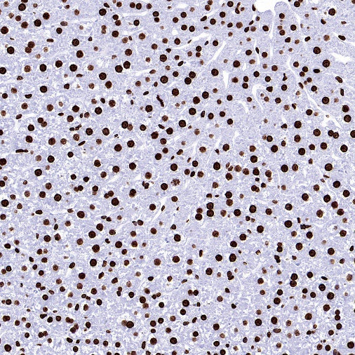 Histone H3 (tri methyl K9) Recombinant Rabbit mAb (S-3826)