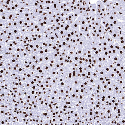 Histone H3 (tri methyl K9) Recombinant Rabbit mAb (S-3826)