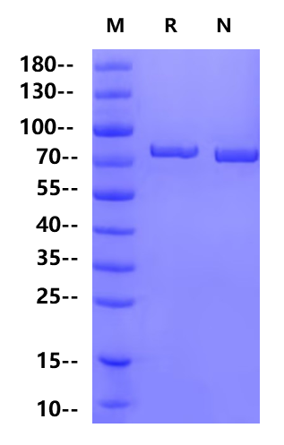 ACSS1 His Tag Protein, Human