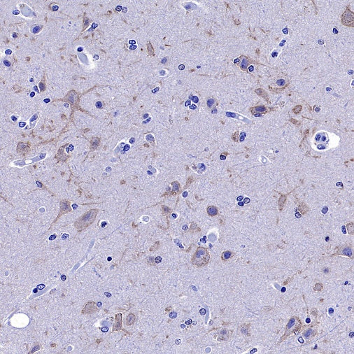 KCNB1 Recombinant Rabbit mAb (S-2527-21)