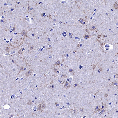 KCNB1 Recombinant Rabbit mAb (S-2527-21)