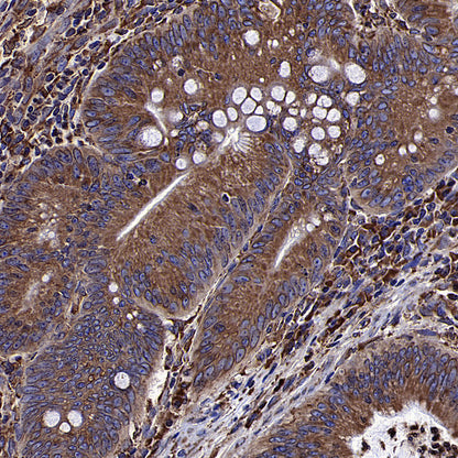 Calreticulin Recombinant Rabbit mAb (S-3920-39)