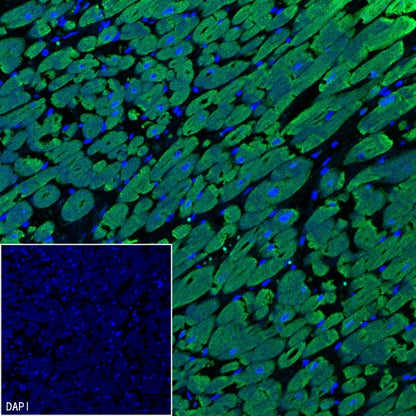 Cardiac troponin T (TNNT2) Recombinant Rabbit mAb (SDT-2894-34)