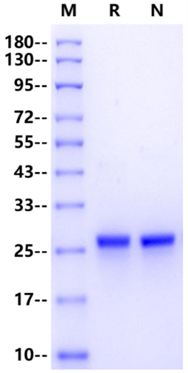 LCN2/NGAL His Tag, Human