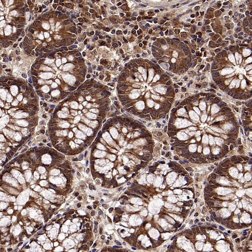 L-Lactate Dehydrogenase A/LDHA Rabbit Polyclonal Antibody