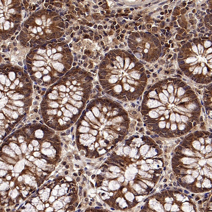 L-Lactate Dehydrogenase A/LDHA Rabbit Polyclonal Antibody