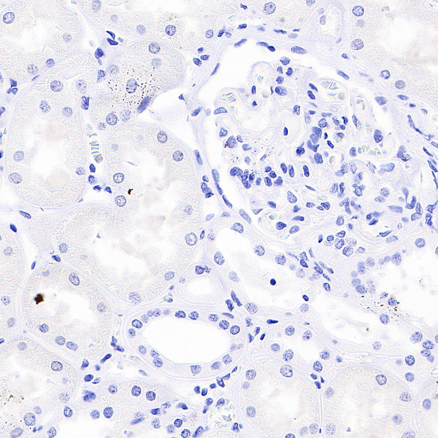 IMP3 Recombinant Rabbit mAb (S-6196)