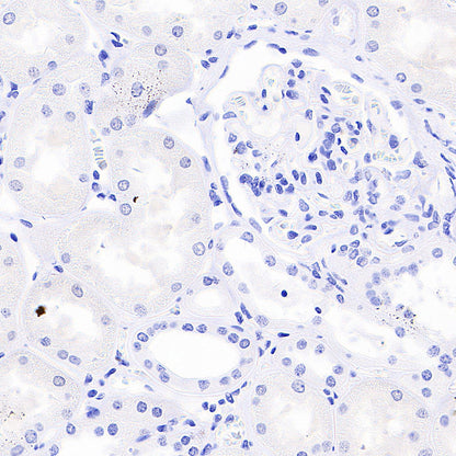 IMP3 Recombinant Rabbit mAb (S-6196)