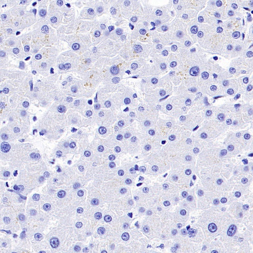 Calbindin Recombinant Rabbit mAb (S-774-378)