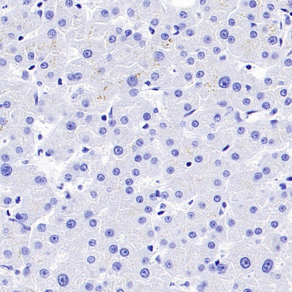 Calbindin Recombinant Rabbit mAb (S-774-378)