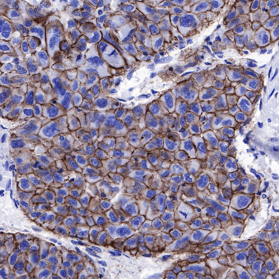β-Catenin Recombinant Rabbit mAb,PBS Only (SDT-336-23)
