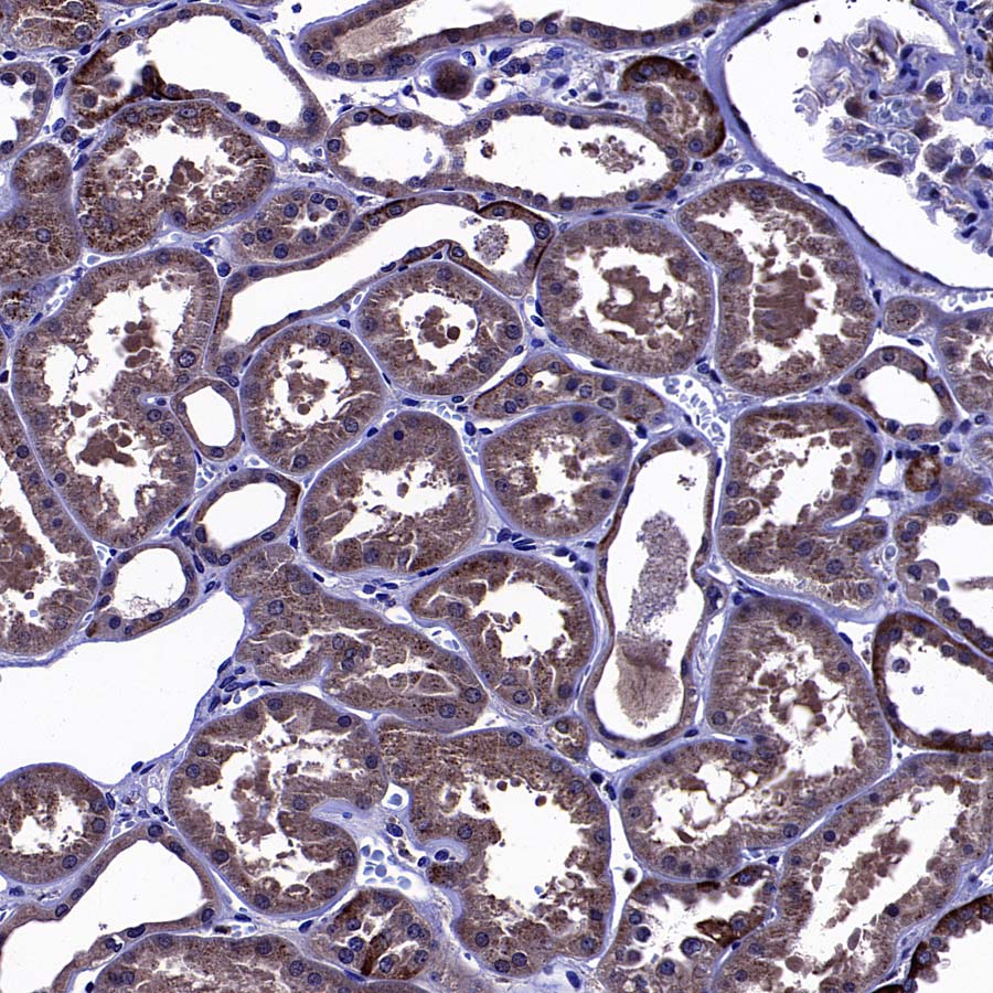 MMP3 Recombinant Rabbit mAb