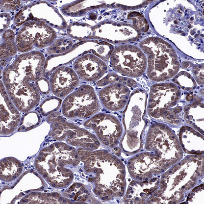MMP3 Recombinant Rabbit mAb