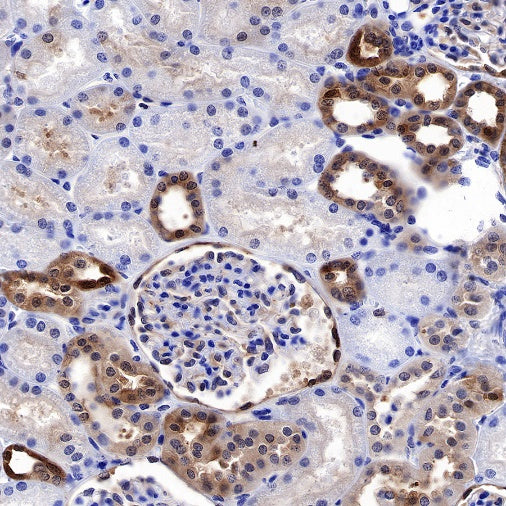 S-RMab® GST-π Recombinant Rabbit mAb (SDT-561-78)