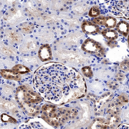 S-RMab® GST-π Recombinant Rabbit mAb (SDT-561-78)