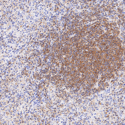 SHIP1 Recombinant Rabbit mAb (S-4235-32)