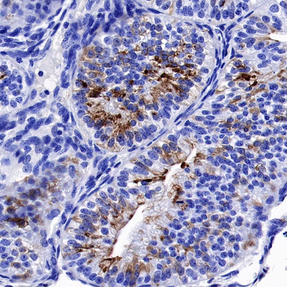Osteopontin Recombinant Rabbit mAb (S-1005-50)