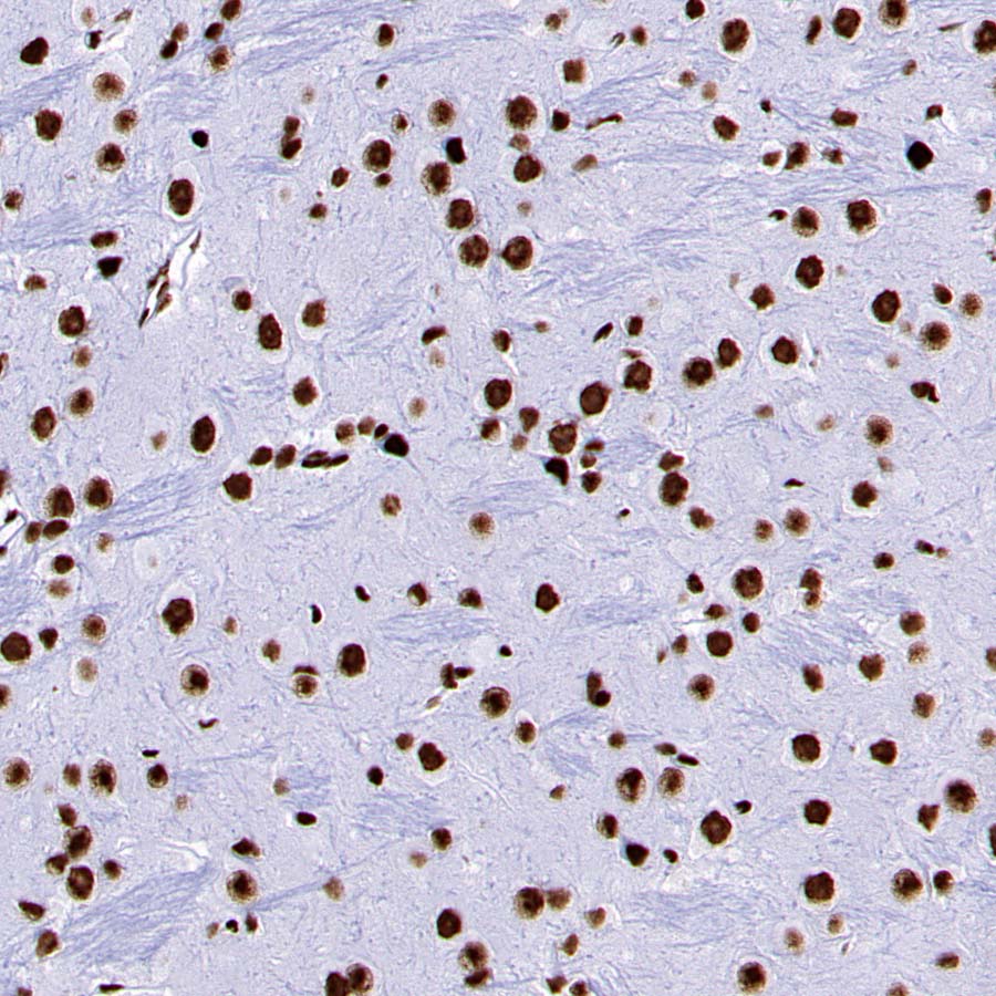 DDX39B Recombinant Rabbit mAb (S-4549-30)